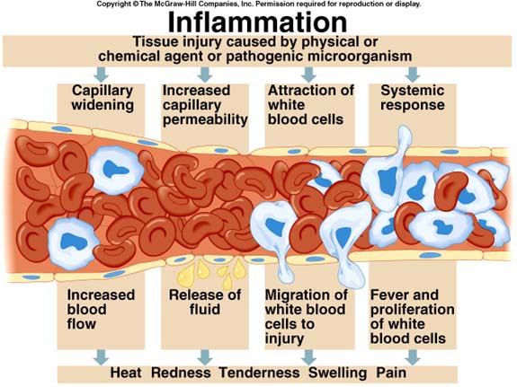 inflammation-diagram.jpg